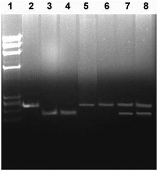 Association of interleukin-4, interleukin-13 gene polymorphisms, HLA-DQ and DR genotypes with genetic susceptibility of type-1 Diabetes Mellitus in Kuwaiti children